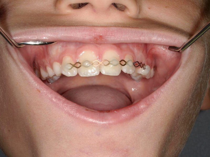 Fallberichtbild Patientenbild Blick in den Mund