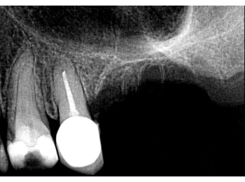 Röntgen Revision 25
