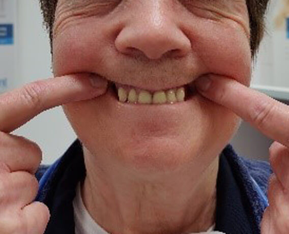 Genau mein Fall erste kosmetische Einprobe