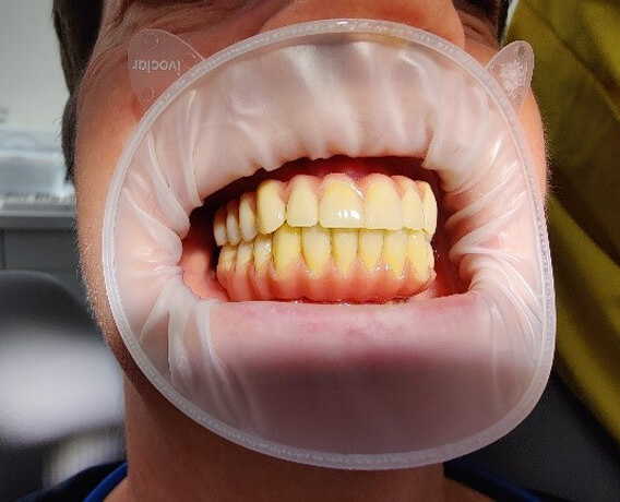 Genau mein Fall Ergebnis nach Behandlung 